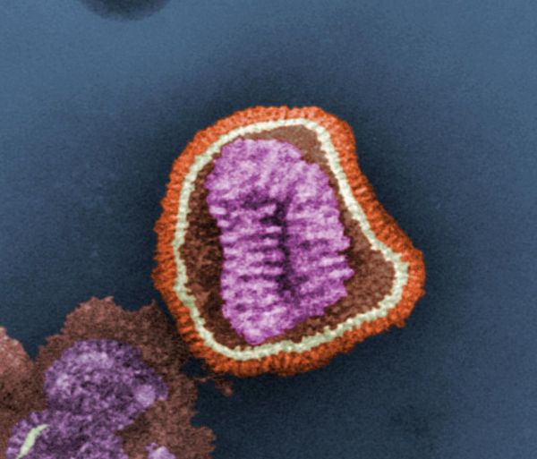 Grippe canine aux États-Unis : le virus asiatique H3N2 est bien en cause