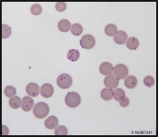 Mycoplasma_haemofelis