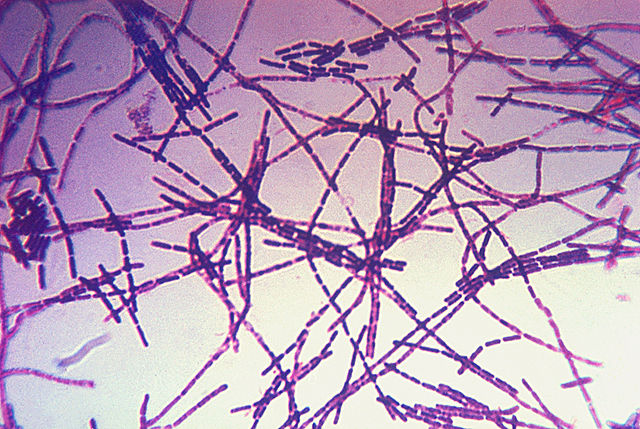 Anthrax charbon Bacillus_anthracis_Gram