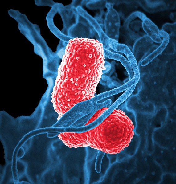 antimicrobien-antibioresistance