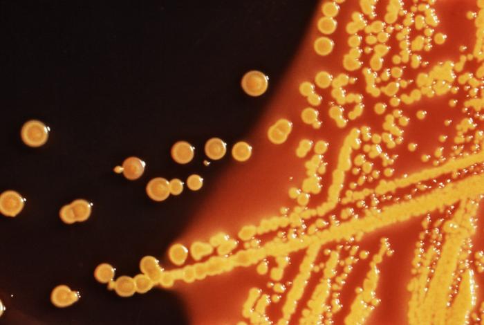 Antibiorésistance: le rôle joué par les espèces de rente dans l’émergence et la dissémination de la bactérie résistante chez l’homme est pour le moins controversé et mal compris