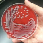 Staphylococcus_aureus.antibioresistance