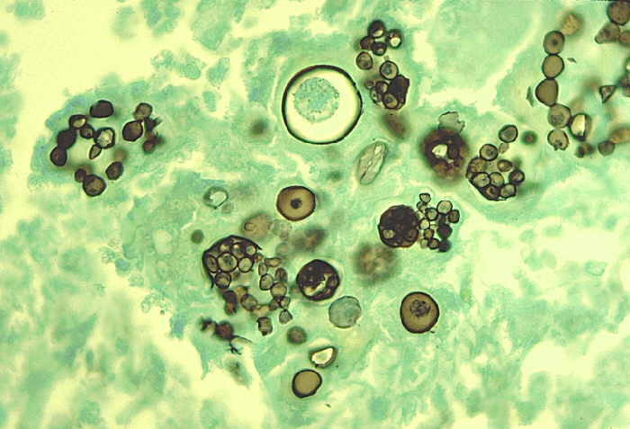 Des champignons qui colonisent les tissus pulmonaires des petits mammifères peuvent également provoquer de graves maladies zoonotiques